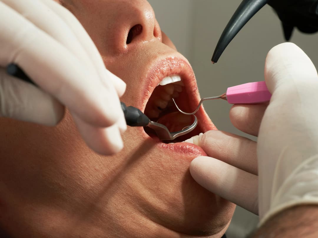Soins dentaires en salle